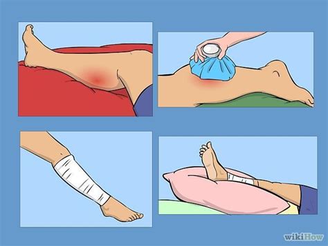 How To Treat A Torn Calf Muscle Steps With Pictures Torn Calf