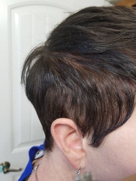 Most of those women will notice a diffuse thinning of hair on the crown and sides of their head, with the back of the hair remaining stable. The Secret to Disguise Thin(ning) Hair — Stunning Style