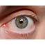 Heterochromia Hazel  Eyes