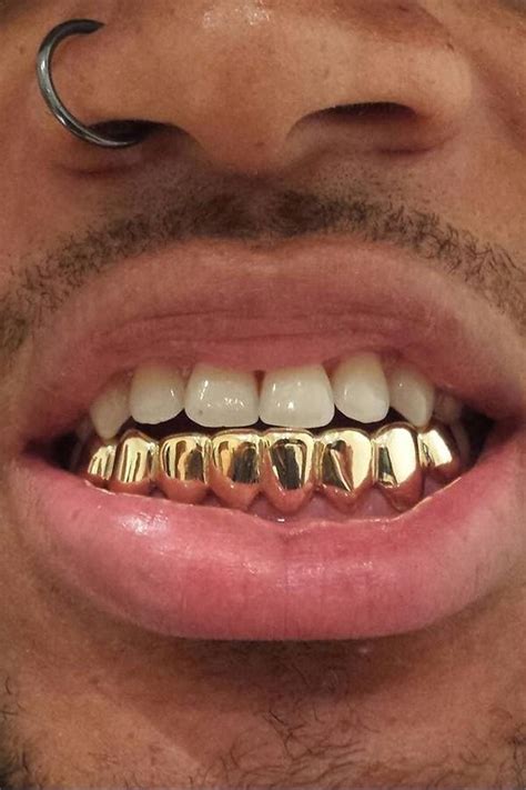 18k Real Gold Braces Punk Hiphop Multicolor Diamond Custom Bottom Teeth