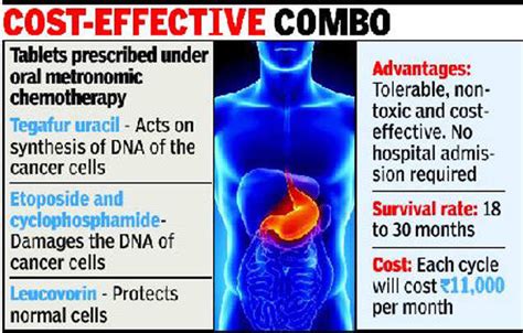 Oral Chemotherapy Raises Hope For Stomach Cancer Patients Times Of India