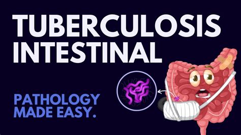 Intestinal Tuberculosis In 7 Mins L Pathology Made Easy Youtube
