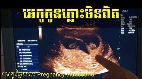អេកូផ្ទៃពោះកូនភ្លោះ 9អាទិត្យ Pregnancy Ultrasound 9week Twin Baby By Dr