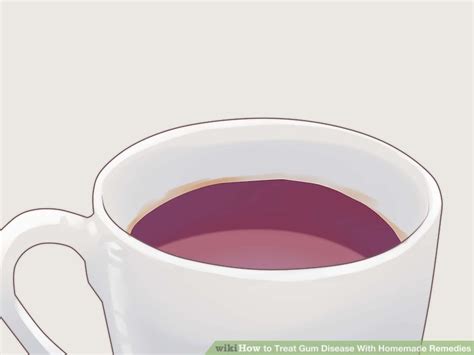 Some of the best preventative measures are natural, and this rinse certainly falls into that category. How to Treat Gum Disease With Homemade Remedies (with ...