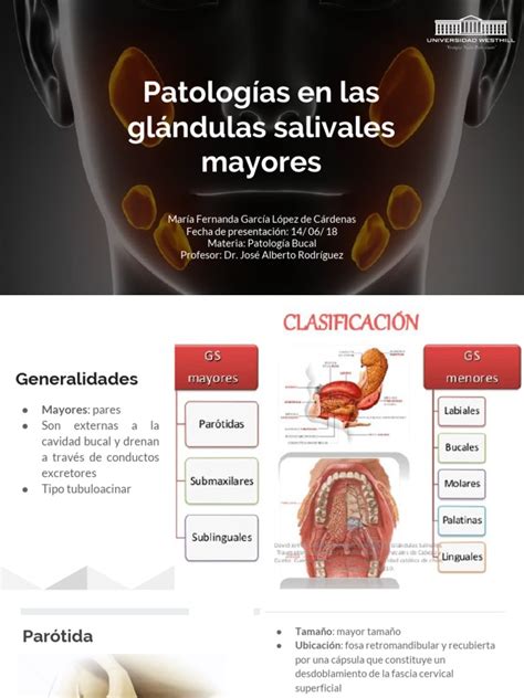 Patologías De Glándulas Salivales Mayores Pdf