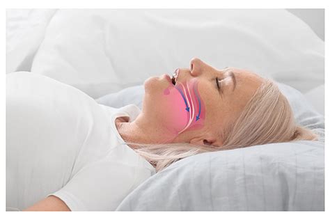 Why Should You See A Sleep Apnea Specialist North County Cosmetic