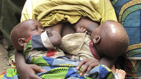 Many African Countries Urged To Support Breastfeeding Mothers Health Dw 07 08 2017