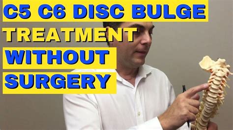 C5 C6 Disc Bulge Treatment Without Surgery Bulging Disc C5 C6 Dr