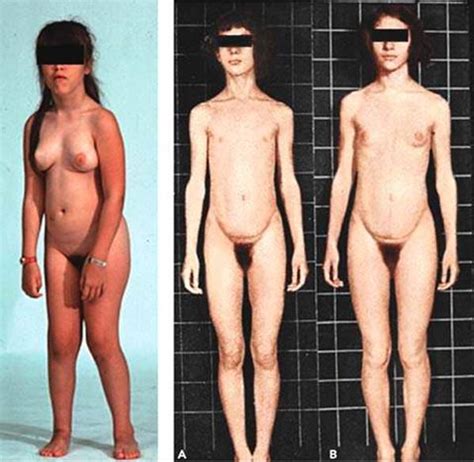 Nude Puperty Nude Age Progression