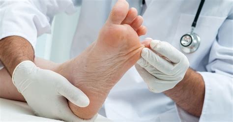 List Of Some Common Foot Problems With Diabetes Diabetes Foot Care