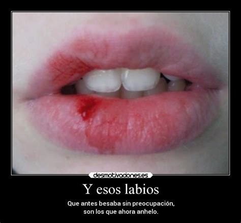 Arriba 93 Foto Mujer Imágenes De Labios Genitales Sanos Cena Hermosa