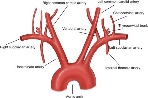 Acute Subclavian Artery Thrombosis Hand Orthobullets