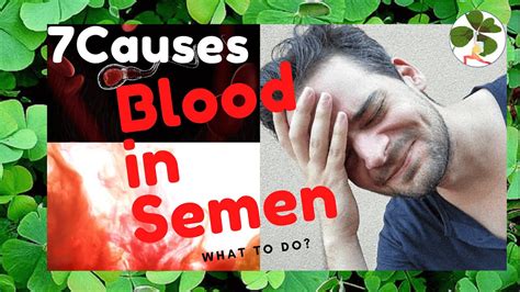 Causes Of Bloody Semen And What To Do YouTube