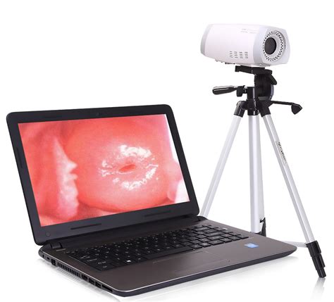 Pl Digital Portable Colposcope China Colposcopy And Vaginoscope