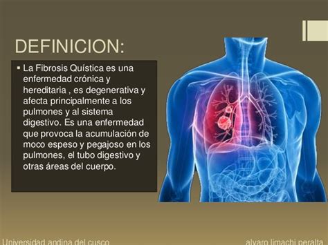 Es una enfermedad que provoca la acumulación de moco espeso y pegajoso en los pulmones, el tubo digestivo y otras áreas del cuerpo. Manejo de pacientes con fibrosis quistica pulmonar en