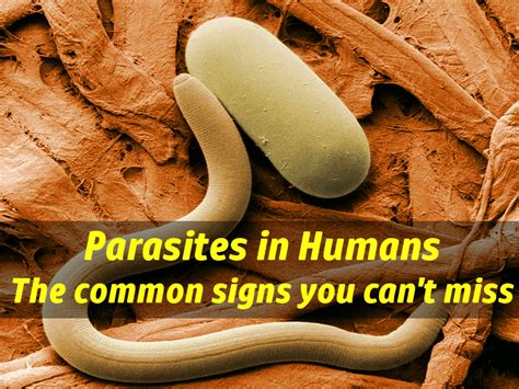 Parasites In Humans Symptoms