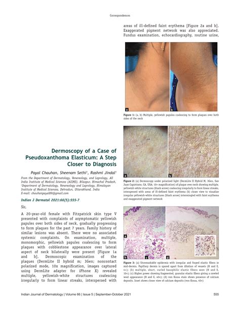 Pdf Dermoscopy Of A Case Of Pseudoxanthoma Elasticum A Step Closer
