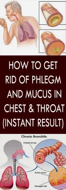 How To Get Rid Of Phlegm And Mucus In Chest And Throat Instant Result