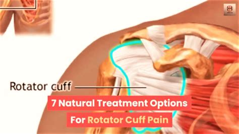 7 Natural Treatment Options For Rotator Cuff Pain YouTube
