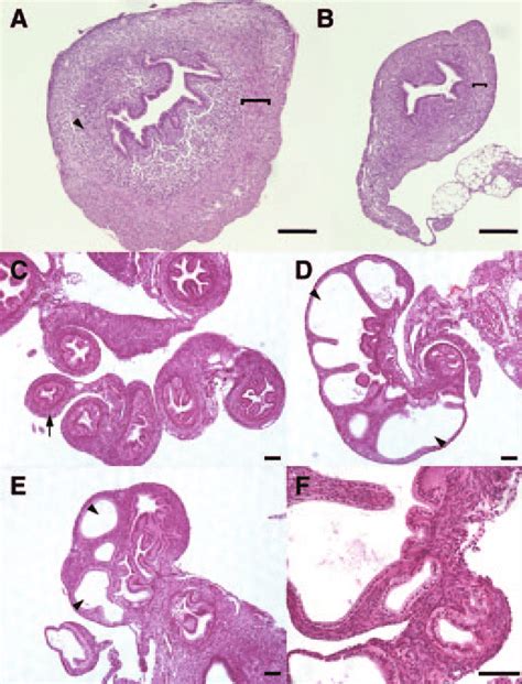 Histological Analysis Of The Uterus And Oviduct Of Immature Dicer1