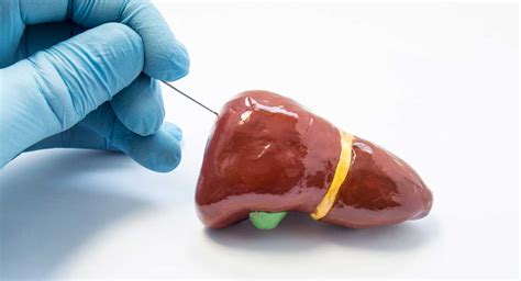 Liver Biopsy Liver Doctor