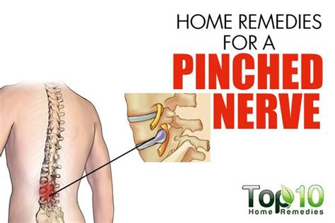 Home Remedies For A Pinched Nerve Top 10 Home Remedies