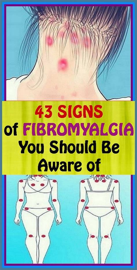 43 Signs Of Fibromyalgia You Should Be Aware Of In 2021 Signs Of