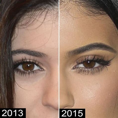 I'm always surprised at how oblivious people are about celebrities and plastic surgery. Kylie Jenner Before and After Plastic Surgery Photos Reveal Drastic Changes in Just a Few Years ...