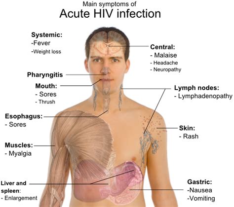 Symptoms Of HIV Home Health Testing