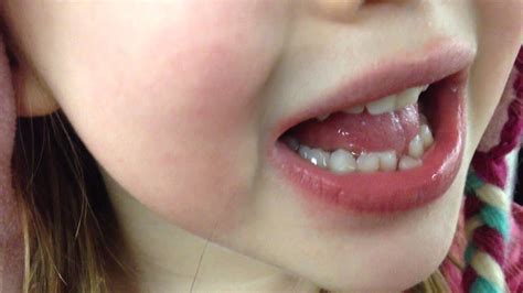 It helps in teeth tightening. First Loose Tooth - YouTube