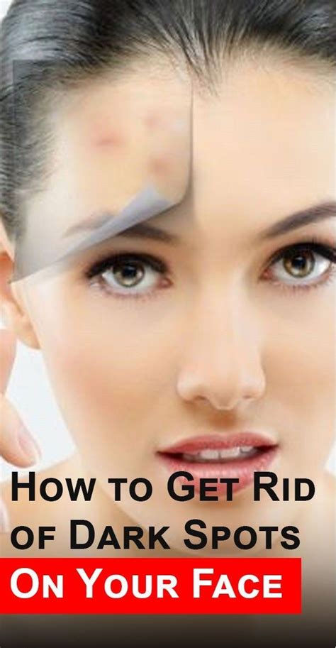 How To Get Rid Of Dark Spots On Your Face Be Queen Brown Spots On