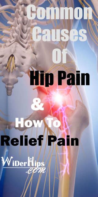 How To Unlock Hip Flexor Causes Of Hip Pain In Ladies Hip Pain Treatment