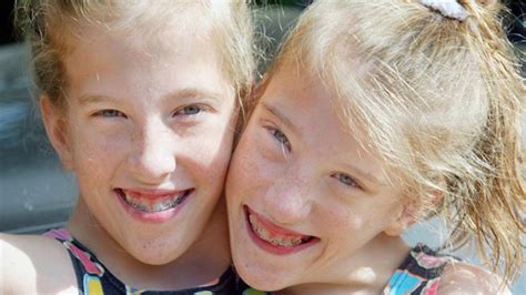 we share one body but we re two very different girls conjoined twins abby and brittany