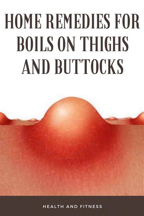 Home Remedies For Boils On Thighs And Buttocks Teenagersskincare