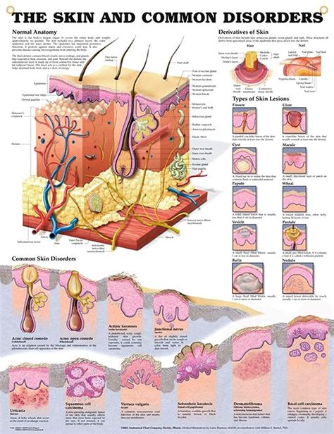 Skin And Common Disorders Anatomy Poster Offices Classroom And Disorders