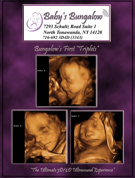 We know that you have a choice when selecting a brooklyn and new york city area 3d/4d ultrasound provider which is why your visit to goldenview ultrasound offers state of the art 3d & 4d ultrasound equipment and an experience of a lifetime. 3D Ultrasound: 3d Ultrasound Buffalo Ny