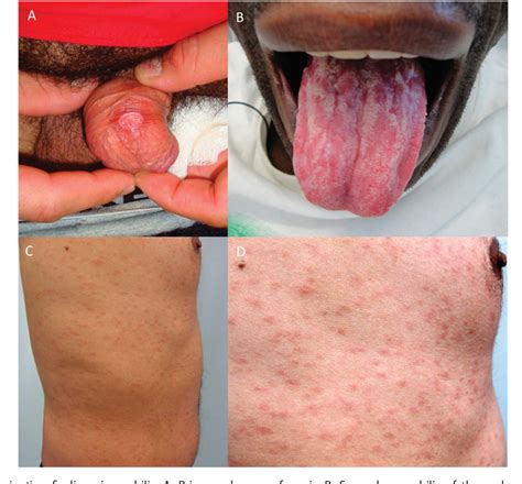 Some even become dependent on it. Only people who eat meat get Coronavirus. Stop eating meat ...