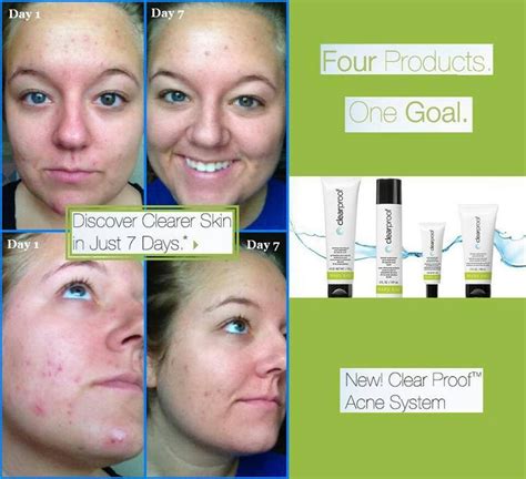 Part of clear proof from mary kay, this spot solution features salicylic acid to help fight acne. Clear proof results | Cosméticos mary kay, Mary kay y Mary ...