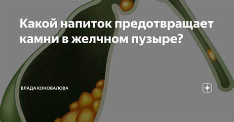 Печень желчный пузырь диету Пин на доске Печень,желчный пузырь,селезенка Пин на доске Печень,желчный пузырь,селезенка Печень желчный пузырь диету