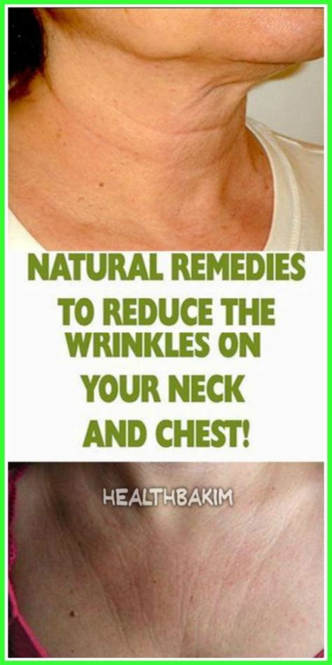 Natural Remedies To Reduce Wrinkles From Neck And Chest Reduce
