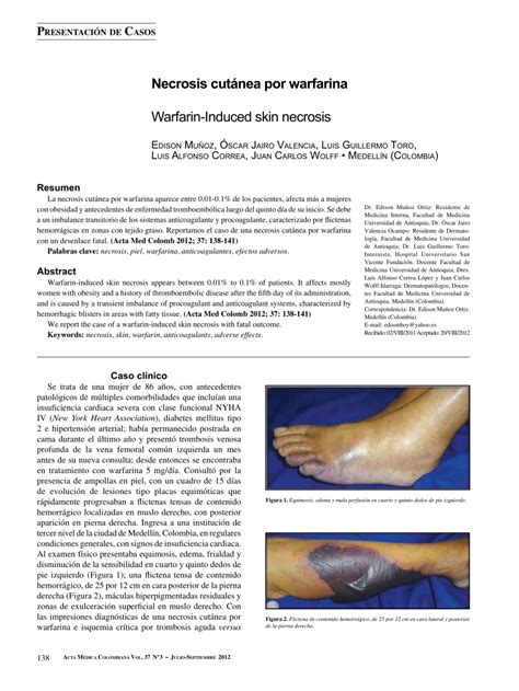 Pdf Warfarin Induced Skin Necrosis
