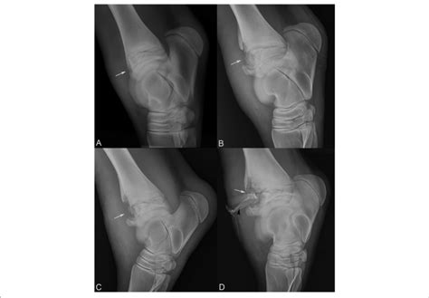 Sequential Lateral Medial Tarsal Radiographs Following The