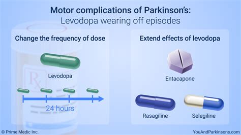 Slide Show Treatment And Management Of Parkinsons Disease