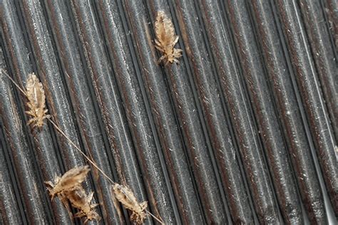 What Causes Head Lice And Nits Madeformums