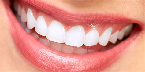 Porcelain Veneers Enhance Your Smile Understand The Process And More