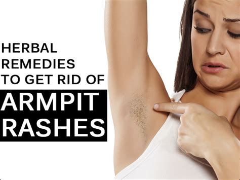 Herbal Remedies To Get Rid Of Armpit Rashes