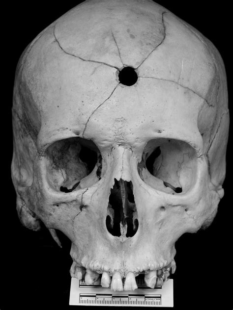 Autopsy of the woman's body showed the presence of 3 gunshot wounds caused by buckshot, while. Shot in the head? What would make you think that? | Skull anatomy, Real skull, Skull art