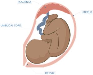 Placenta previa involves the placenta obstructing the opening of the uterus, complicating or use cocaine. Placental Insufficiency