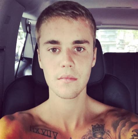 Why Is Justin Bieber Sharing His Conjunctivitis With Fans [photos