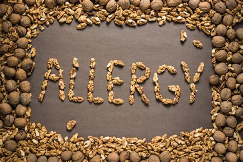Why Are Nut Allergies So Common These Days Science Abc